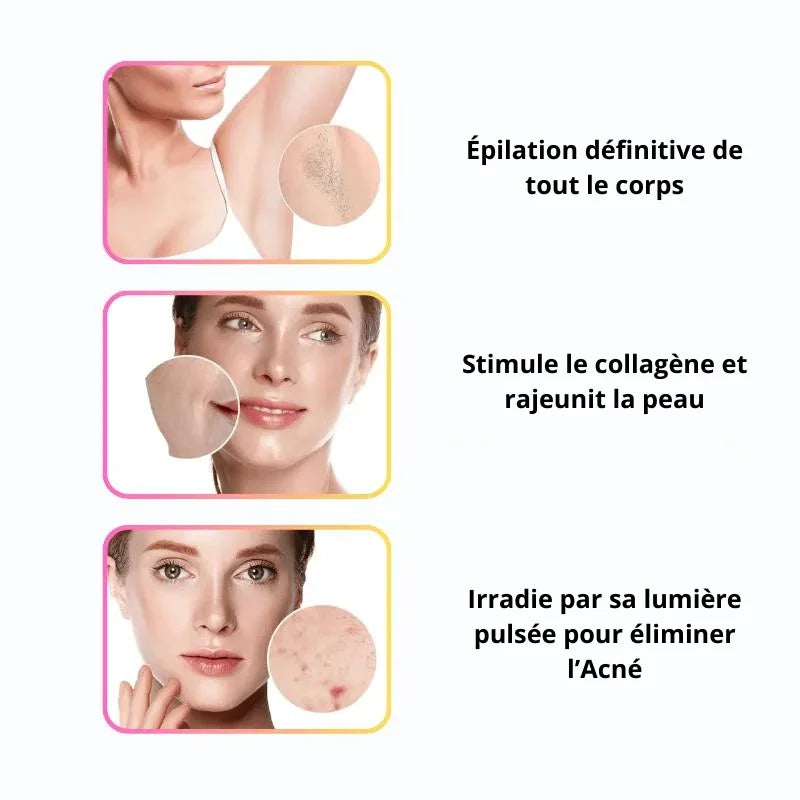 Épilateur Laser - IPL