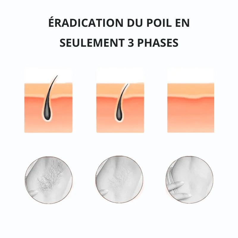 Épilateur à Lumière Pulsée - Écran LCD