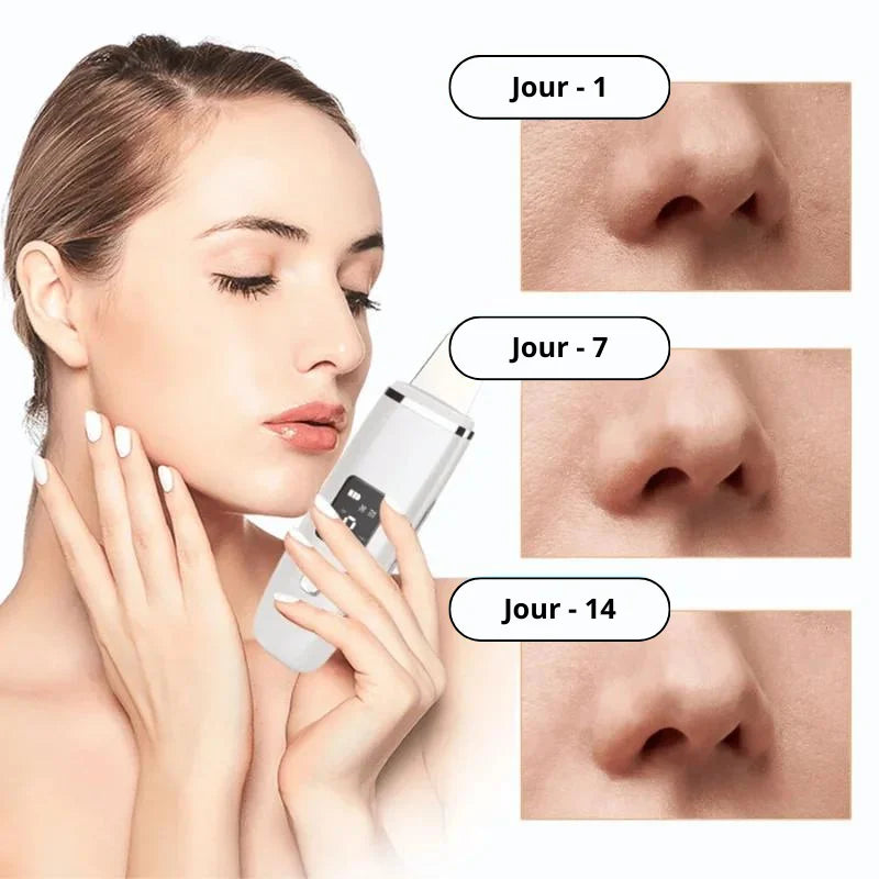 Épurateur de Peau Lifting Facial à Ultrasons