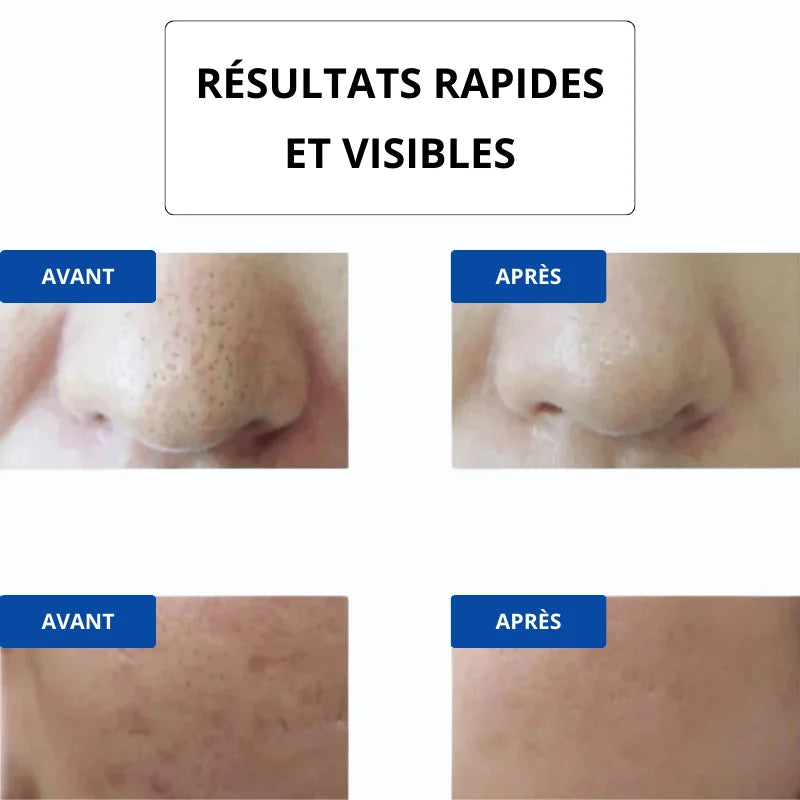 Masque LED Visage 7 Couleurs