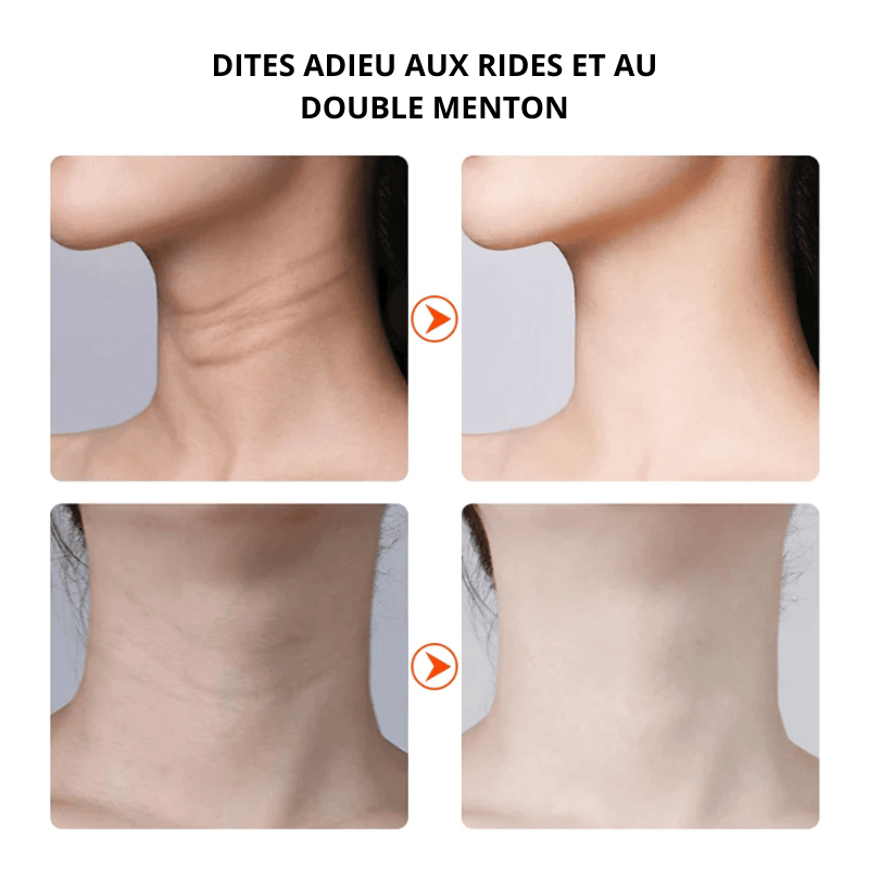 Solution Ultime Anti-Rides & Double Menton